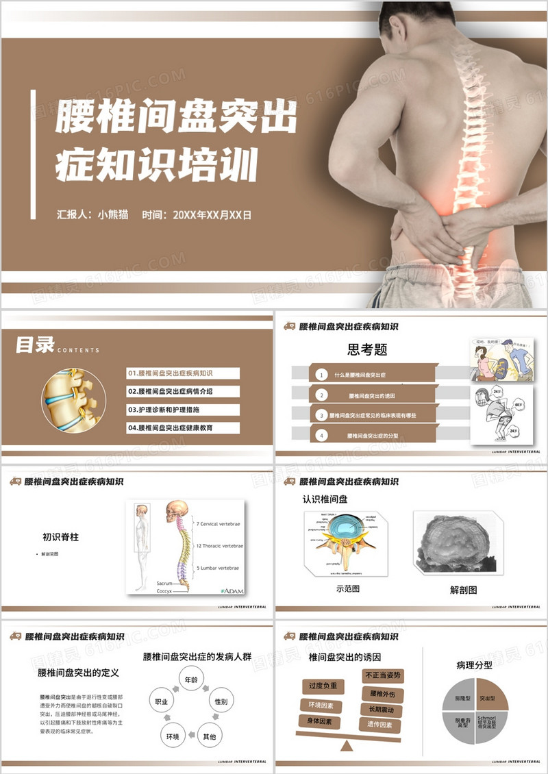 腰椎间盘突出症知识培训PPT模板