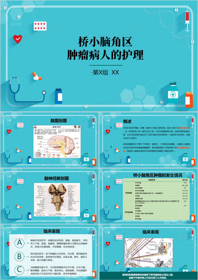 蓝色简约风小脑肿瘤术后护理查房PPT模板