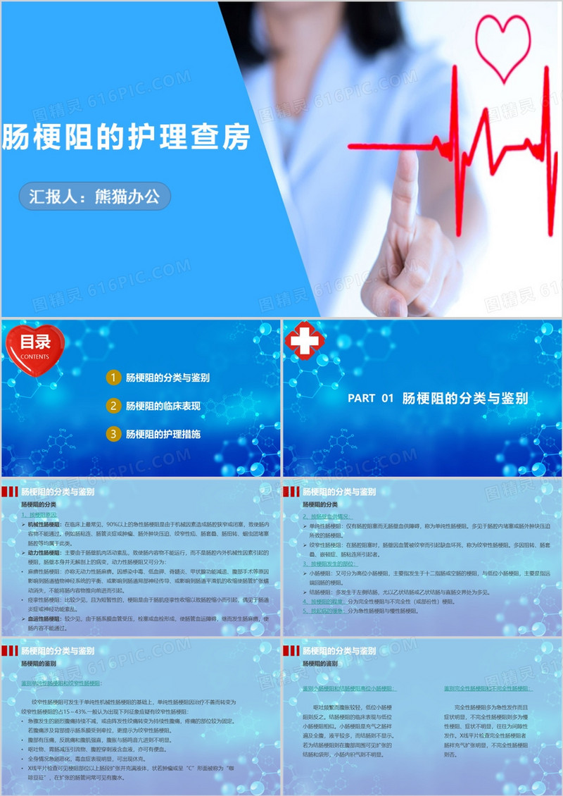 蓝色肠梗阻的护理查房介绍PPT模板