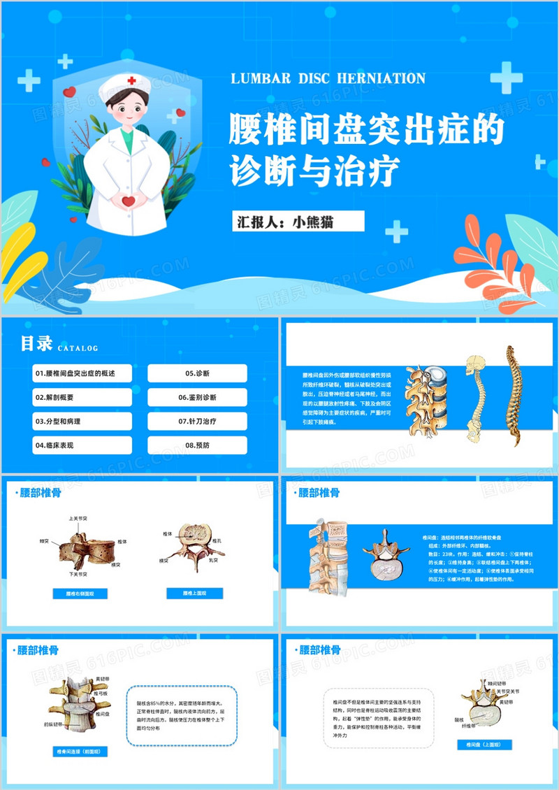 腰椎间盘突出症的诊断与治疗护理查房PPT模板