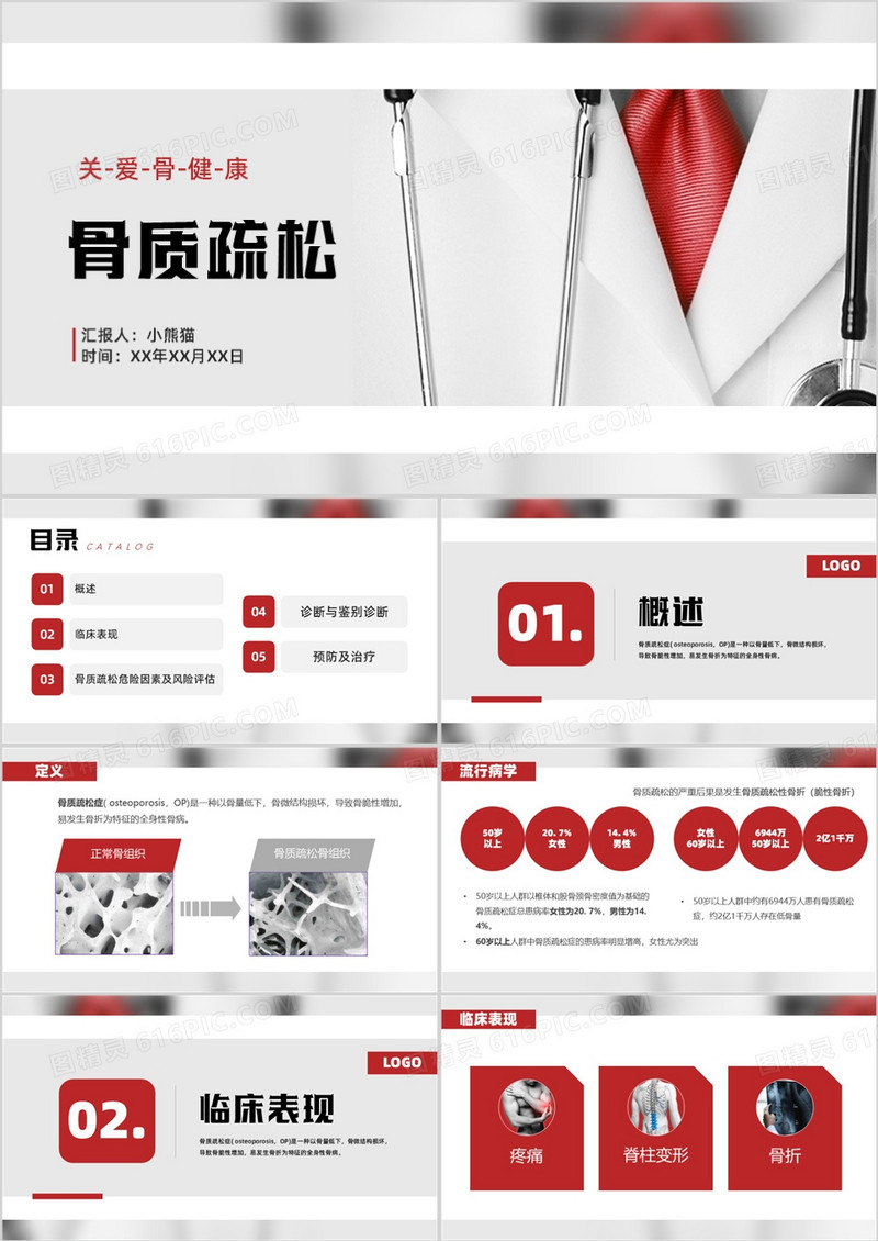 骨质疏松医疗汇报健康知识培训PPT模板
