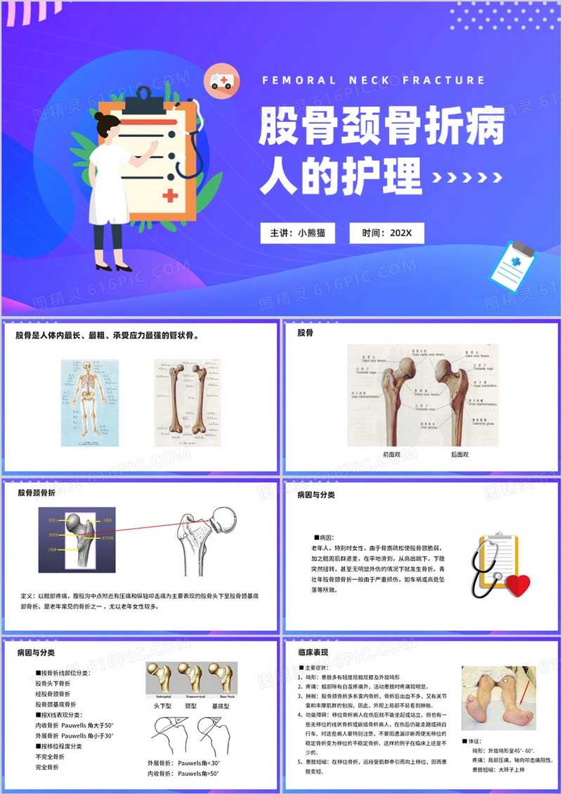 股骨颈骨折病人的护理PPT模板