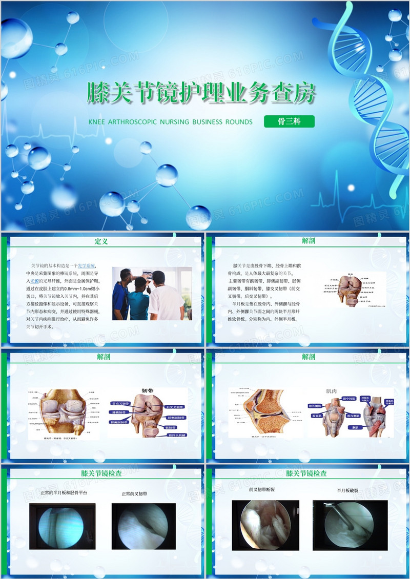膝关节镜护理业务查房PPT模板