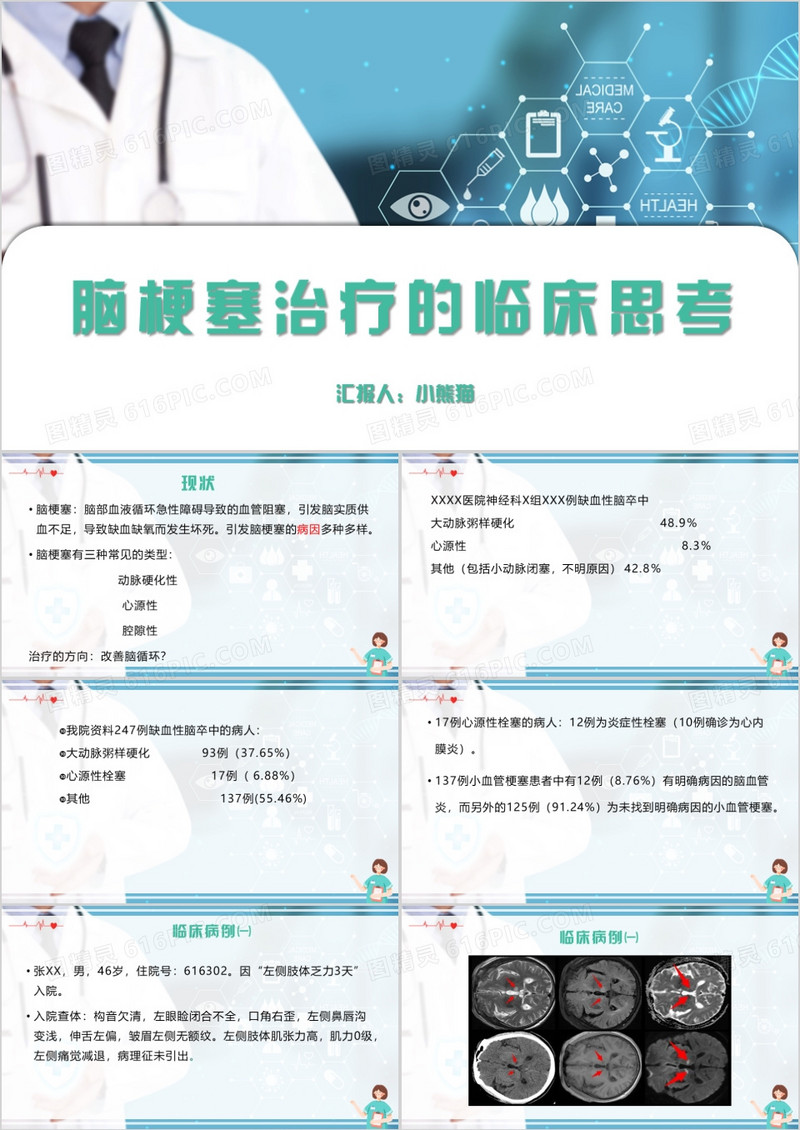 简约风脑梗塞治疗的临床思考PPT模板