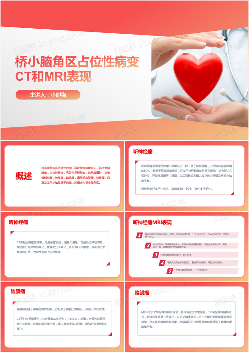 小脑肿瘤术后护理查房PPT模板