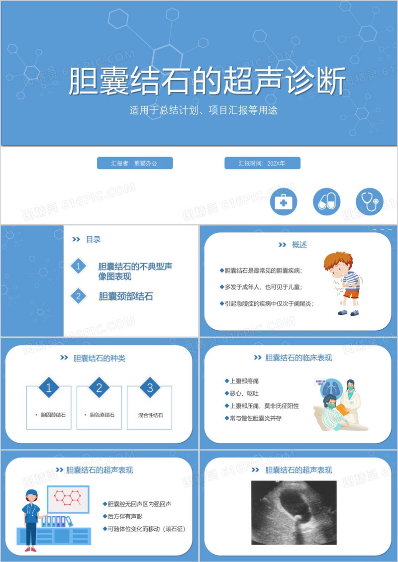 简约风胆囊结石的超声诊断PPT模板