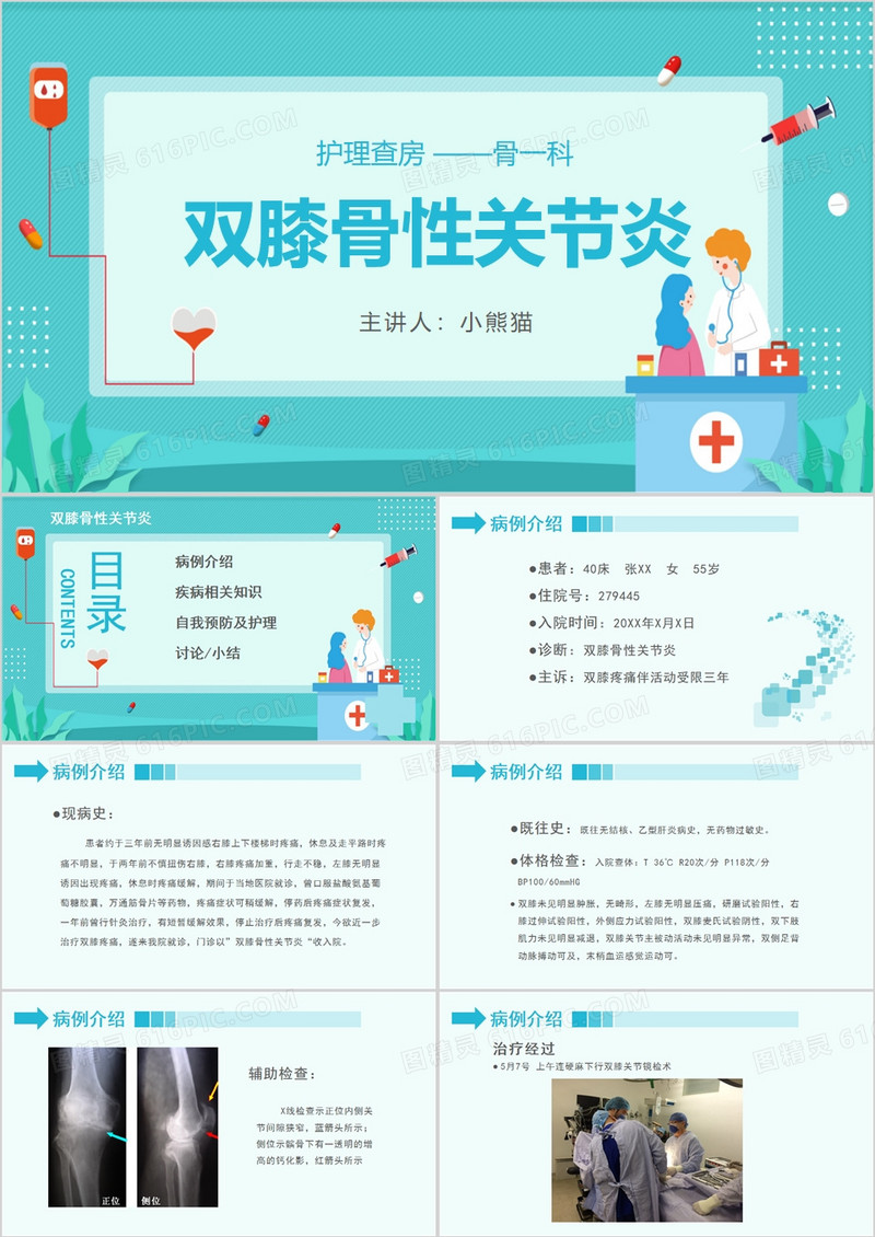 医学医疗双膝关节炎护理查房PPT模板