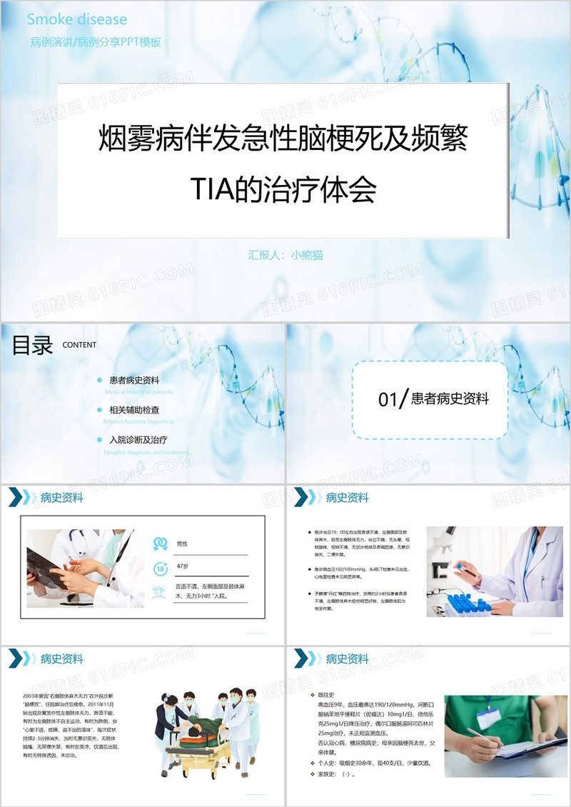 烟雾病治疗病例演讲PPT模板