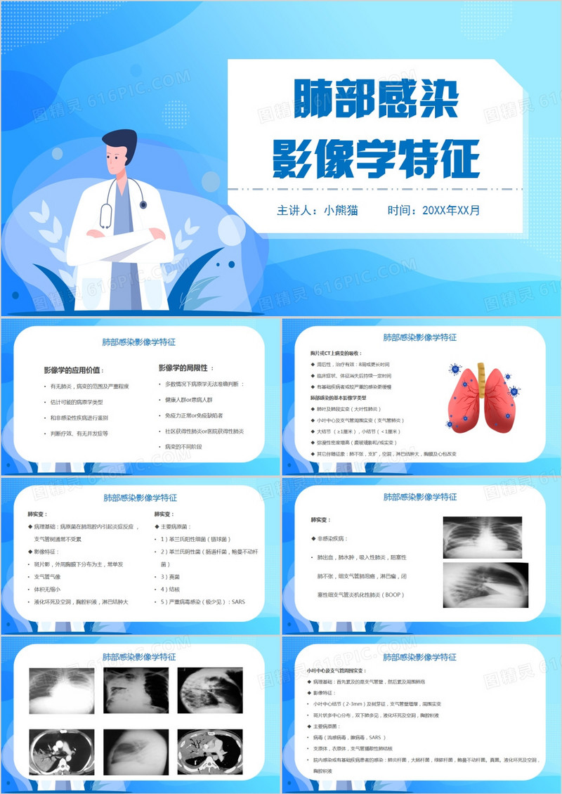 肺部感染护理查房肺部感染影像学特征PPT模板