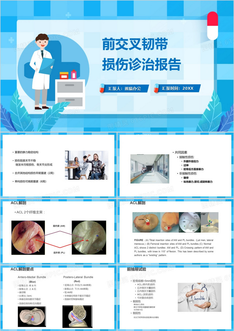交叉韧带损伤诊治报告PPT模板