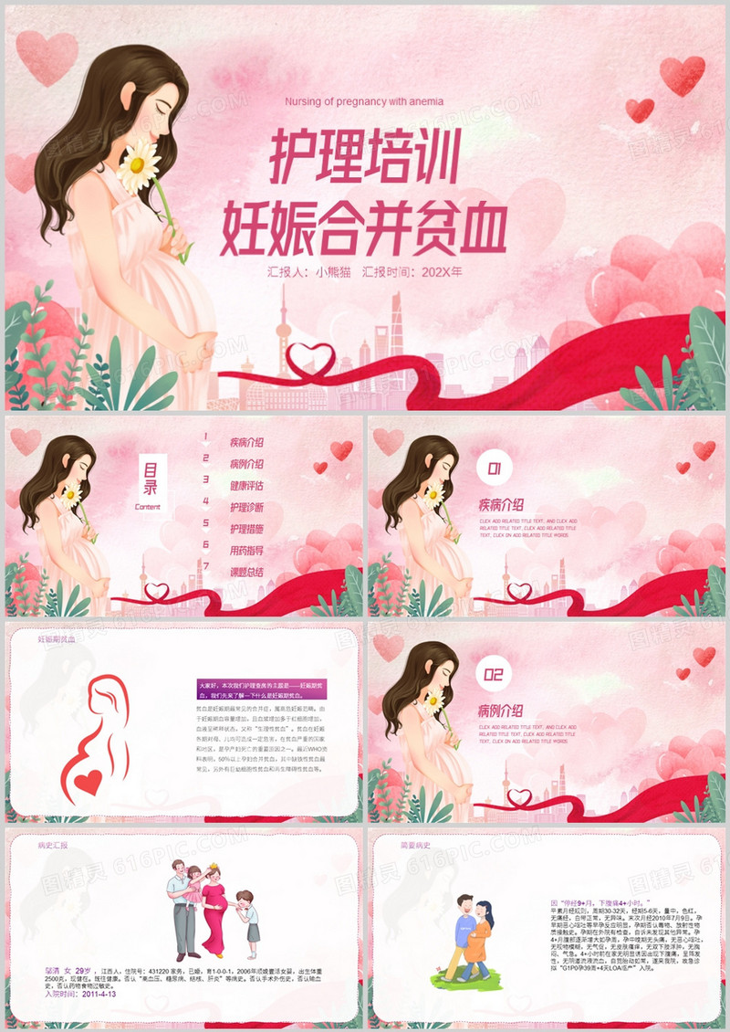 护理培训妊娠合并贫血的护理PPT模板