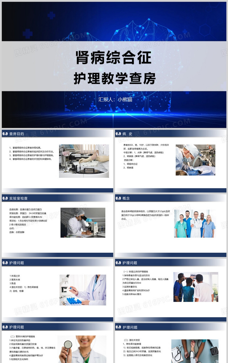 肾病综合征护理教学查房PPT模板