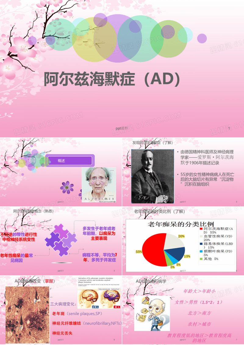 阿尔兹海默症  ppt课件