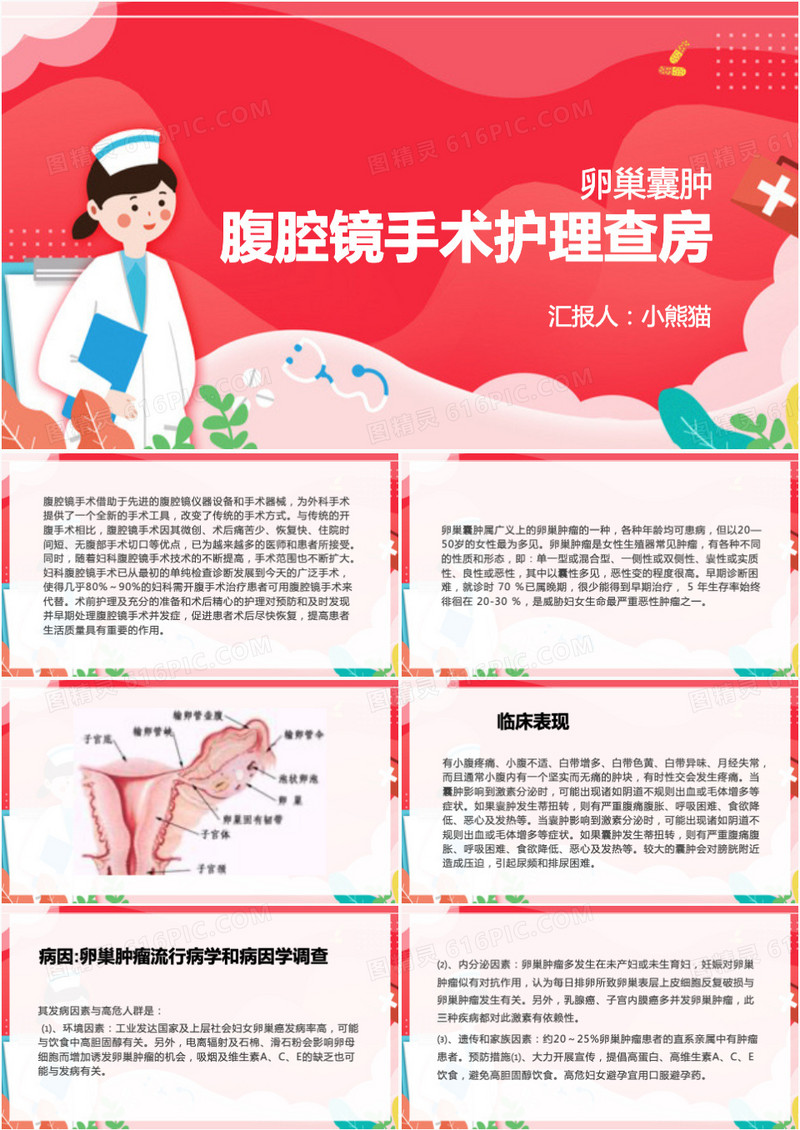 卵巢肿瘤腹腔镜手术护理查房PPT模板