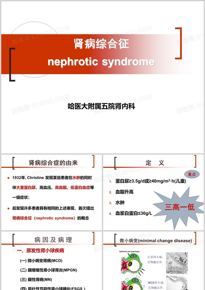 肾病综合征ppt模板
