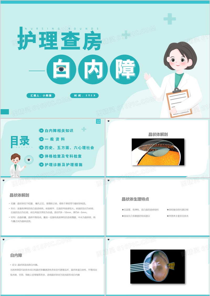 绿色卡通护理查房之白内障PPT模板