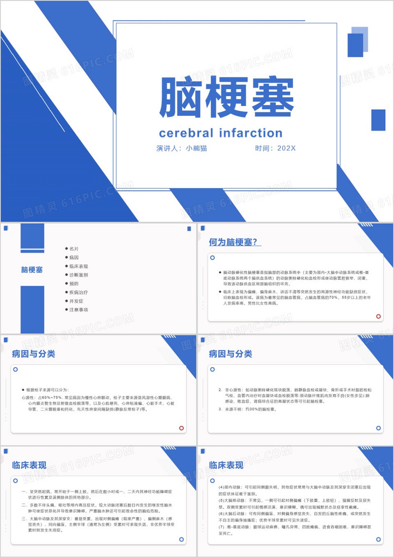 蓝色简约风脑梗塞护理查房PPT模板