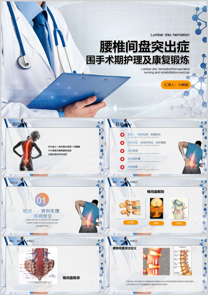 腰椎间盘突出症围手术期护理及康复锻炼PPT模板