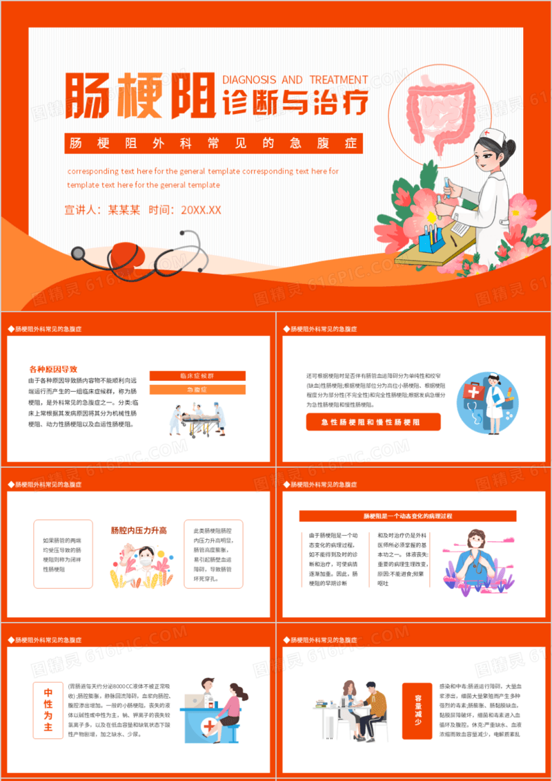 肠梗阻外科常见的急腹症动态PPT模板