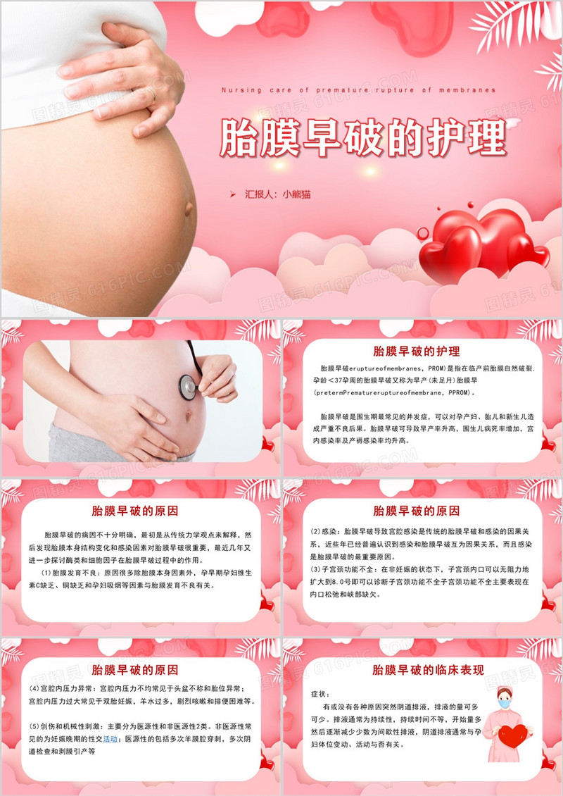 女性母婴母亲生产之胎膜早破的护理PPT模板