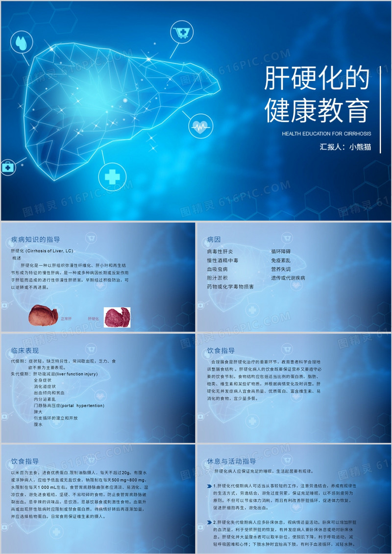 肝硬化患者护理查房肝硬化健康教育PPT模板