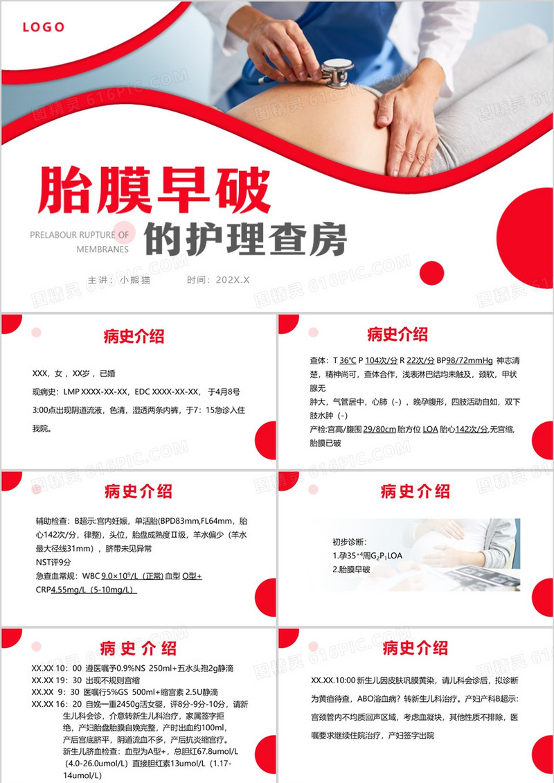 胎膜早破的护理查房胎膜早破护理查房PPT模板