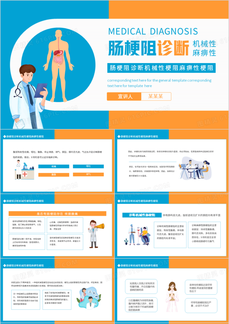 肠梗阻诊断机械性梗阻麻痹性梗阻动态PPT模板