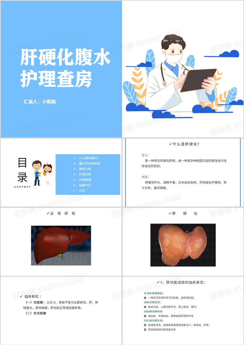 肝硬化腹水患者护理查房PPT模板