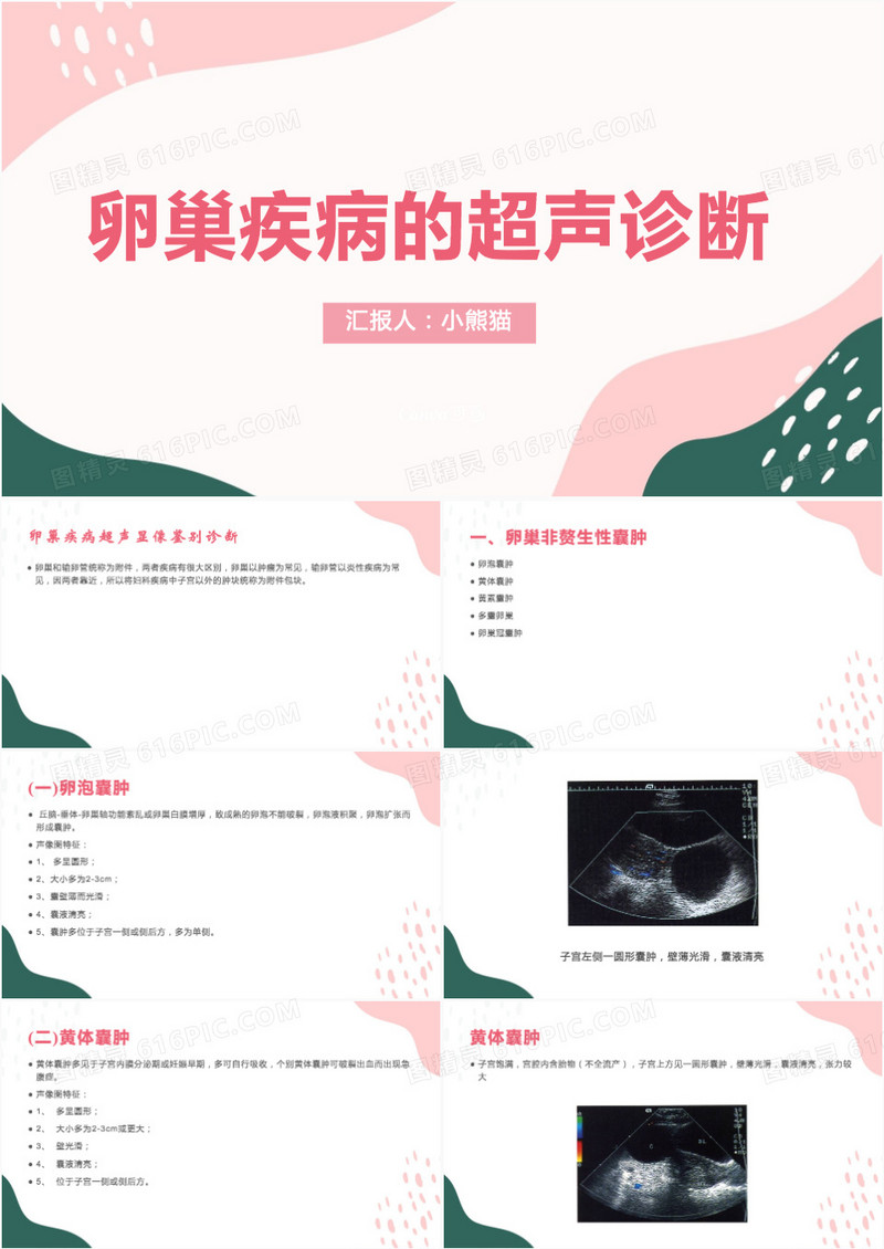 卵巢癌护理查房卵巢疾病的超声诊断PPT模板