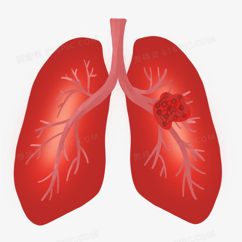 卡通手绘肺部癌症元素