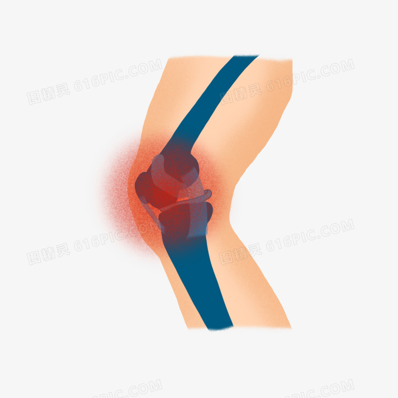 手绘膝关节膝关节疼痛免抠元素