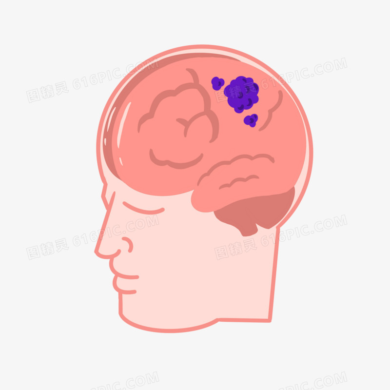 手绘脑部肿瘤免抠元素