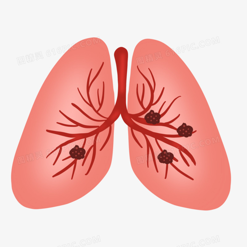 卡通手绘肺部肿瘤元素