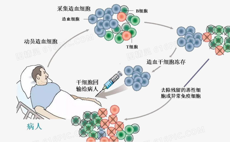 干细胞移植技术