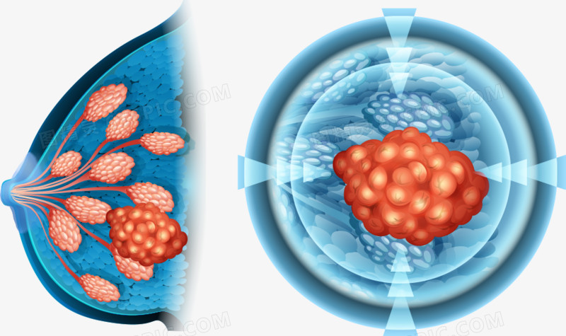矢量乳房