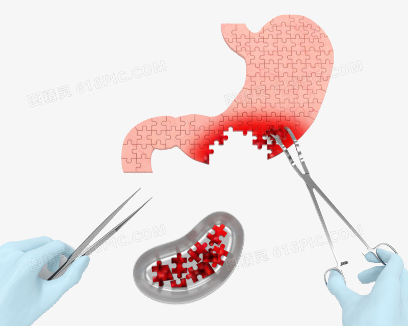 做胃痛手术的外科医生