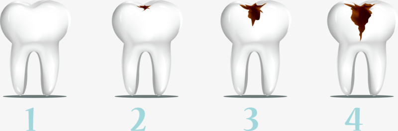 卡通牙齿破损的过程