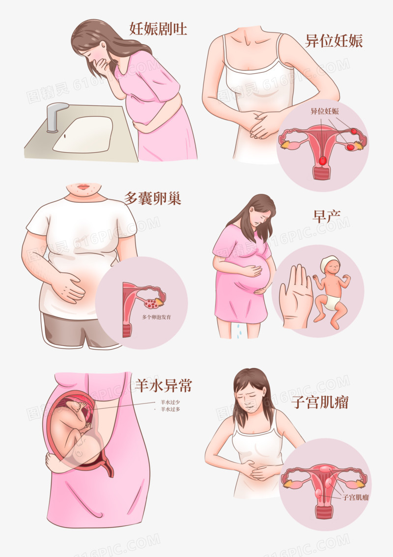 一组手绘孕妇妊娠医疗科普插画元素