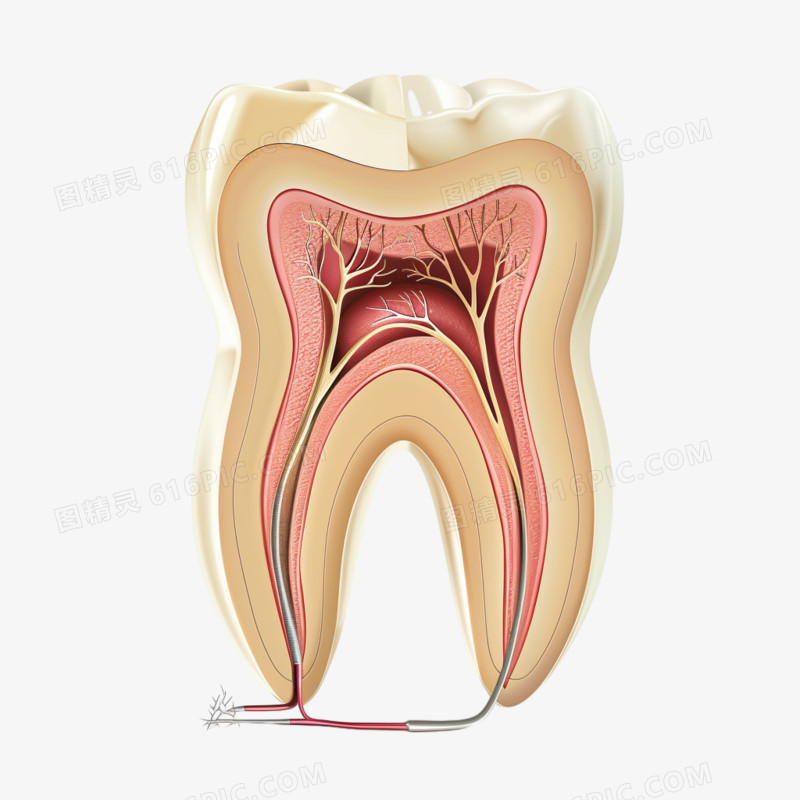 3D蛀牙坏齿神经治疗元素