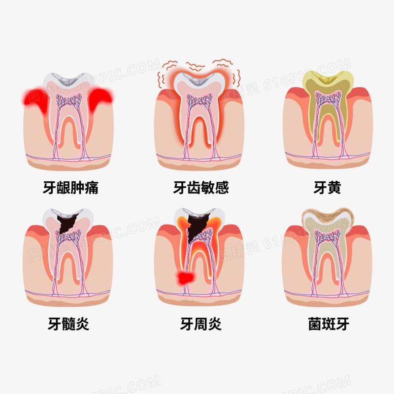 一组手绘牙齿疾病套图