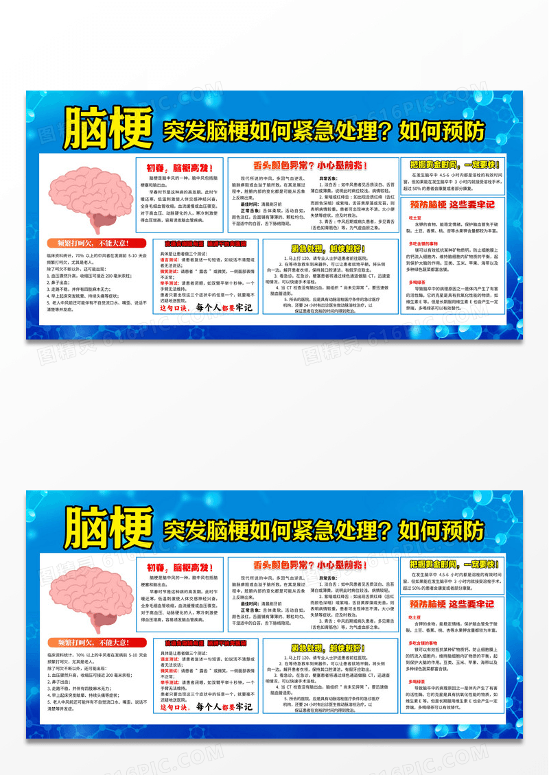 蓝色卡通脑梗突发脑梗如何紧急处理展板夏季健康