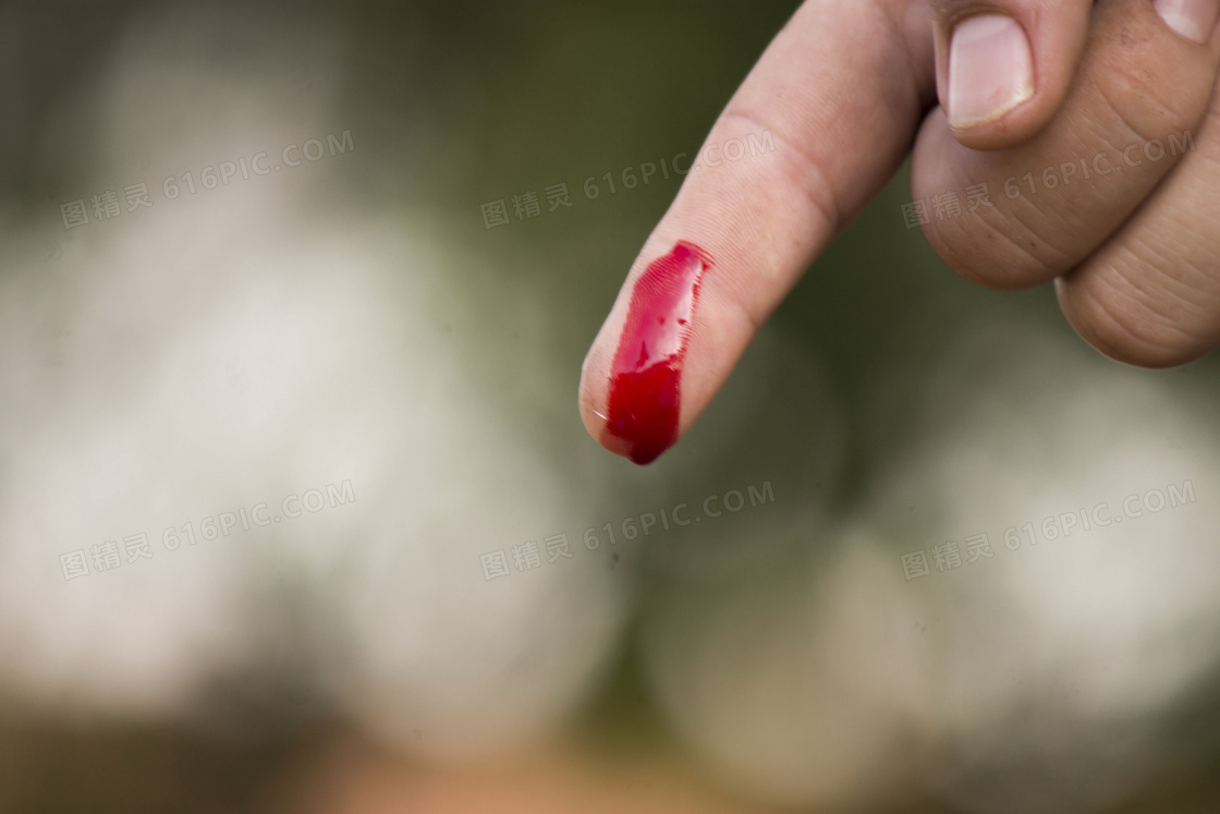 手指流血图片