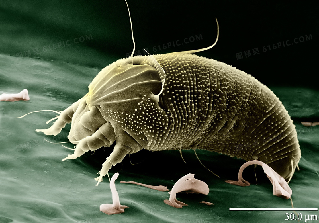 白色背景中的吸血昆虫螨 库存照片. 图片 包括有 皮肤, 寄生生物, 昆虫, 的闪烁, 小蜘蛛, 吸血动物 - 171281114
