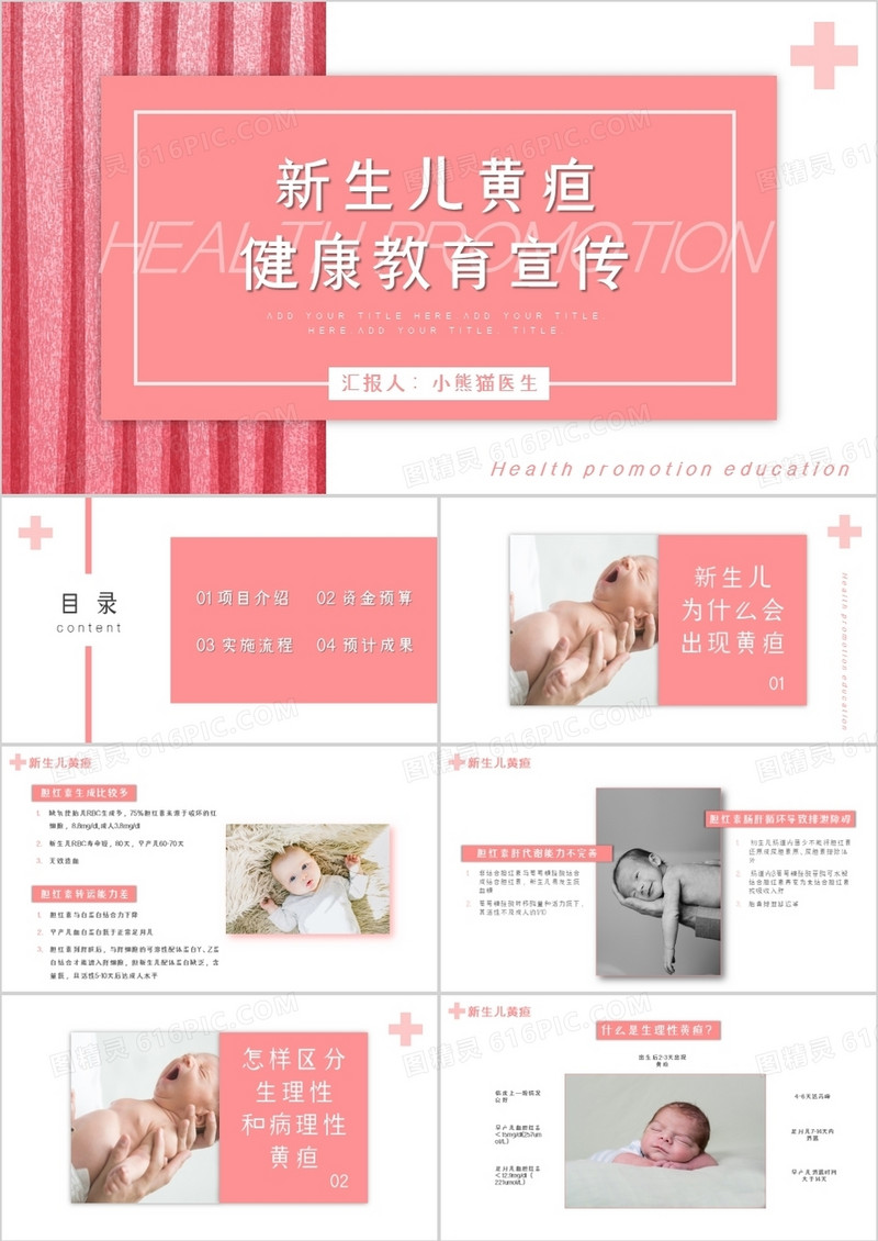 新生儿黄疸健康教育宣传通用PPT模板