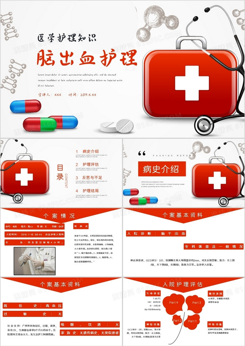脑出血护理案例分析教学PPT模板