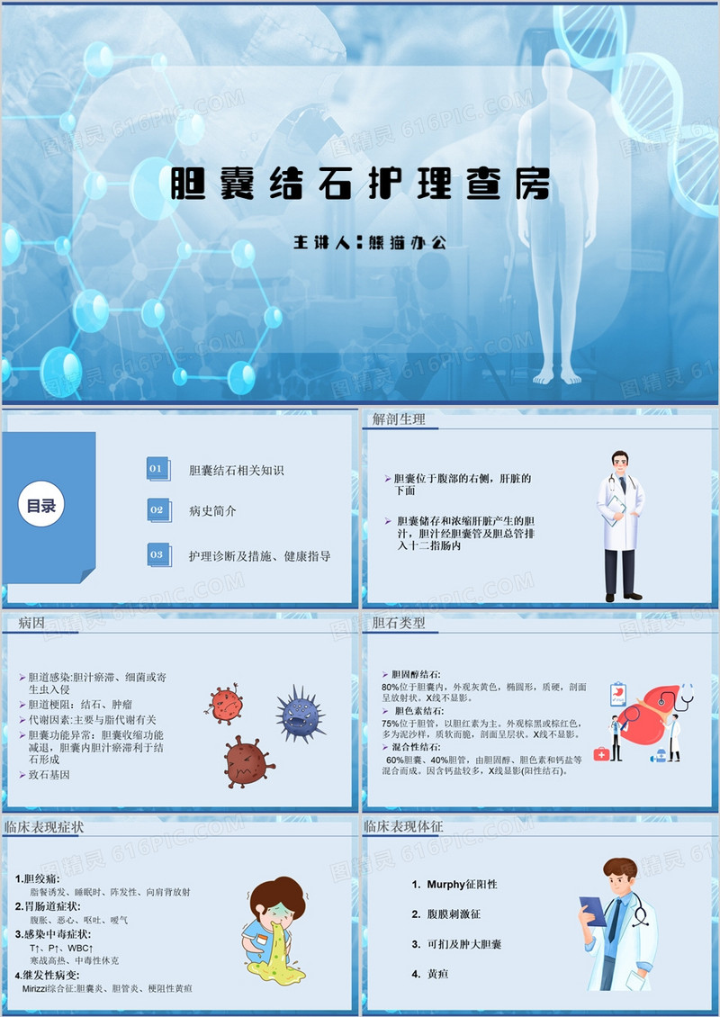 简约风胆囊结石护理查房PPT模板