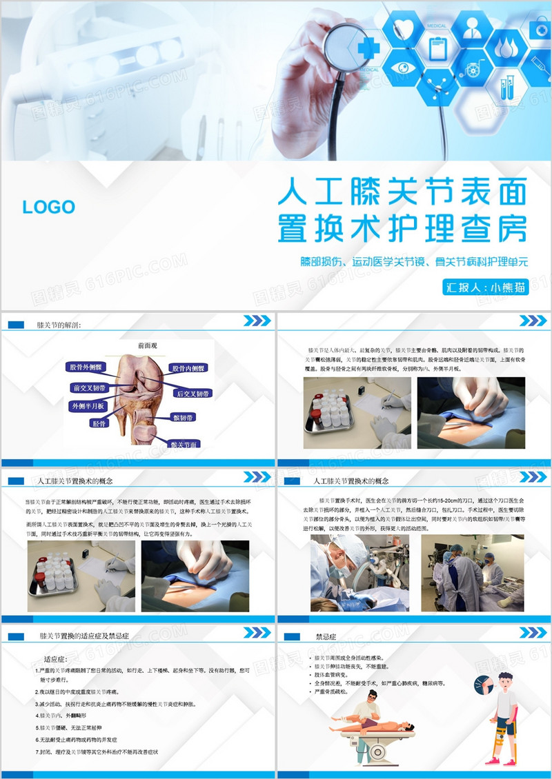 人工膝关节表面置换术护理查房PPT模板