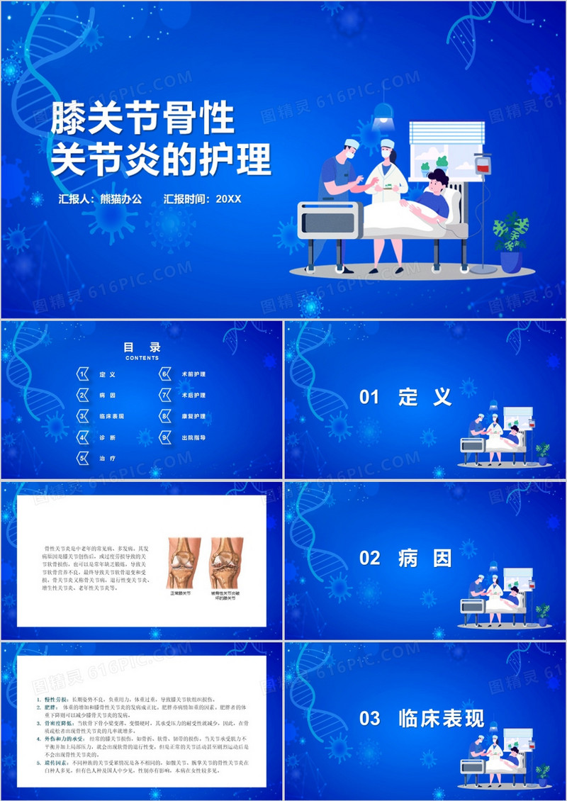 膝关节骨性关节炎的护理医疗查房PPT模板