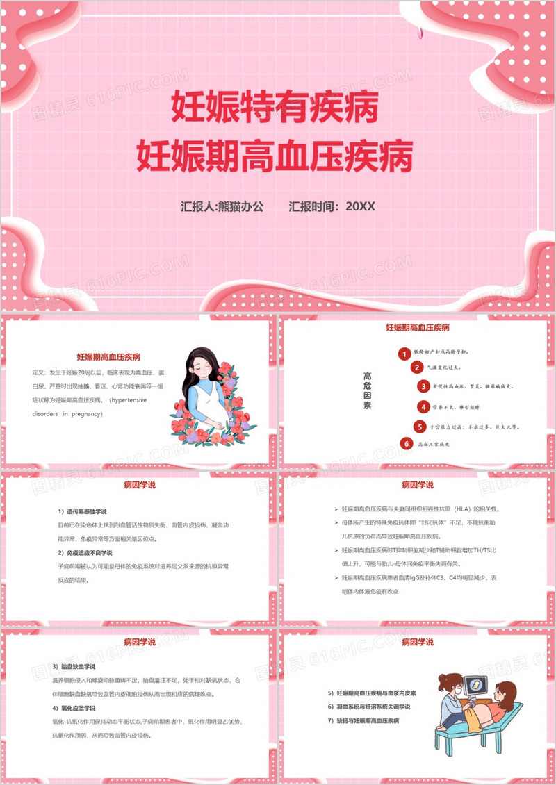妊娠特有疾病妊娠高血压病课件PPT模板