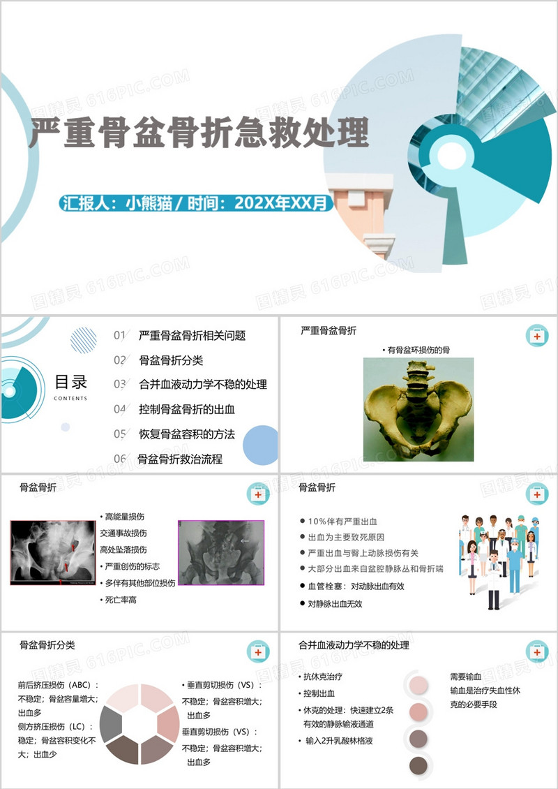 严重骨盆骨折急救处理PPT模板